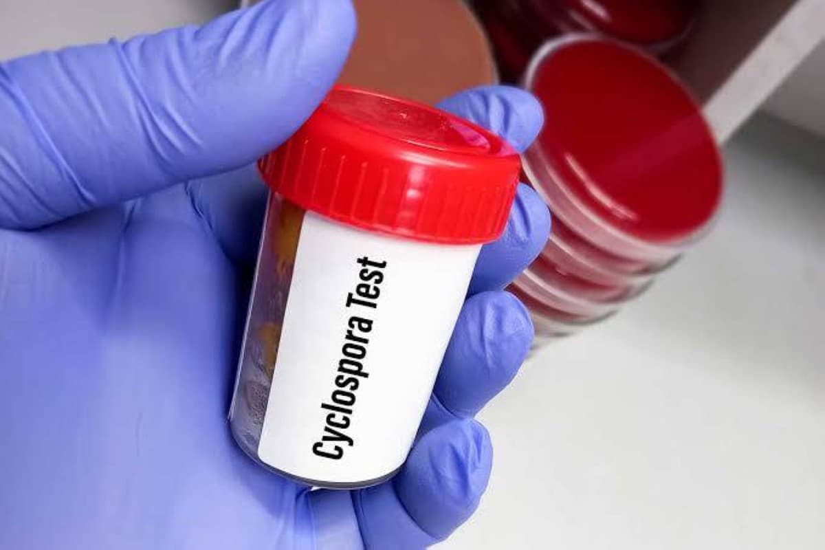 A public health official in Michigan addresses reporters about a widespread Cyclospora parasite outbreak affecting nearly 1,000 residents across the state.