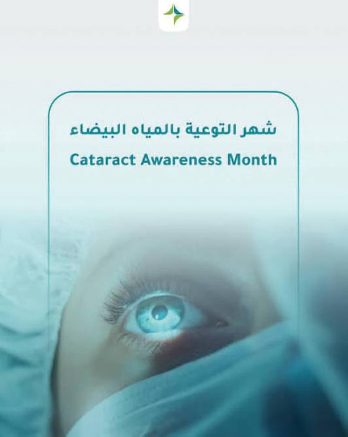A close-up illustration of a human eye affected by cataracts, showing clouding of the lens.