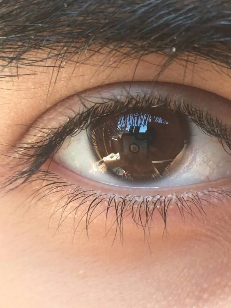 A close-up illustration of the human eye highlighting the role of melanin pigment in eye colour and protection.