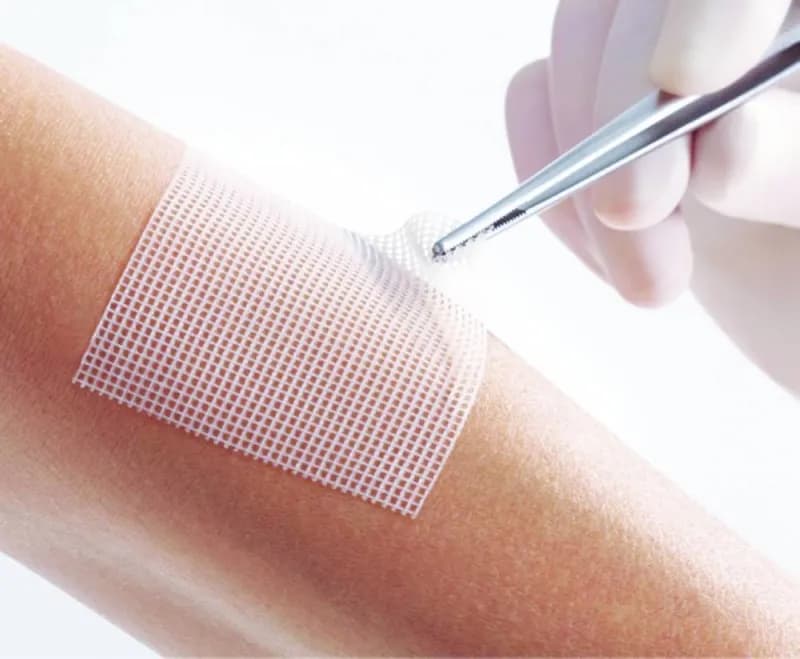 A close-up of a wound dressing applied to skin, illustrating the use of fish collagen hydrogel bandages in medical treatment.